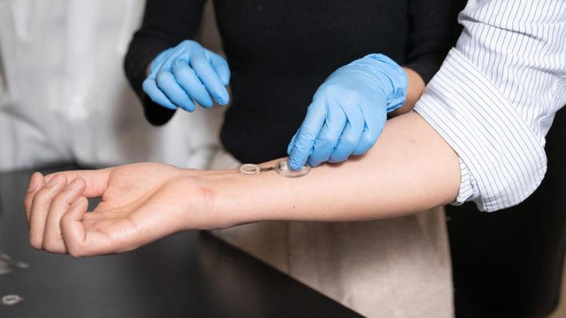 Enfeksiyonu günler önceden tespit eden akıllı bandaj: Caltech’ten iCares devrimi – Birlik Haber Ajansı