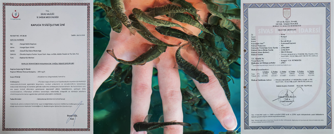 Kangal Balıklı Kaplıca işletmecisi Ünsallar A.Ş.’den basın açıklaması – Birlik Haber Ajansı