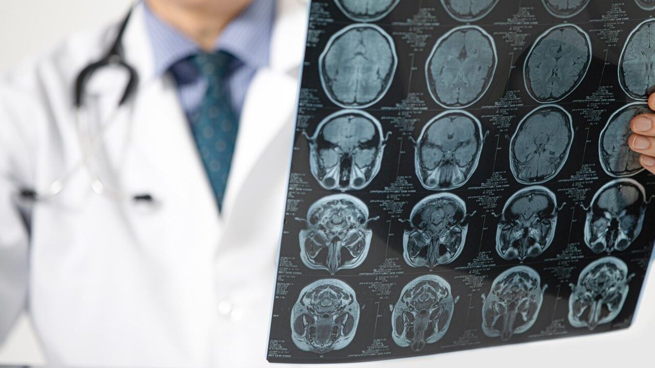 Pandemi beyni yaşlandırdı: Covid olmasanız bile etkilenmiş olabilirsiniz – Birlik Haber Ajansı