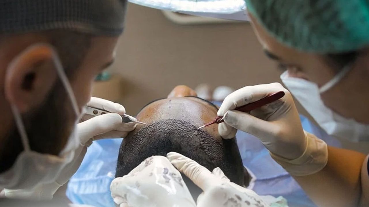 Sağlık Bakanlığı’ndan saç ekimi birimlerinde yeni dönem – Birlik Haber Ajansı