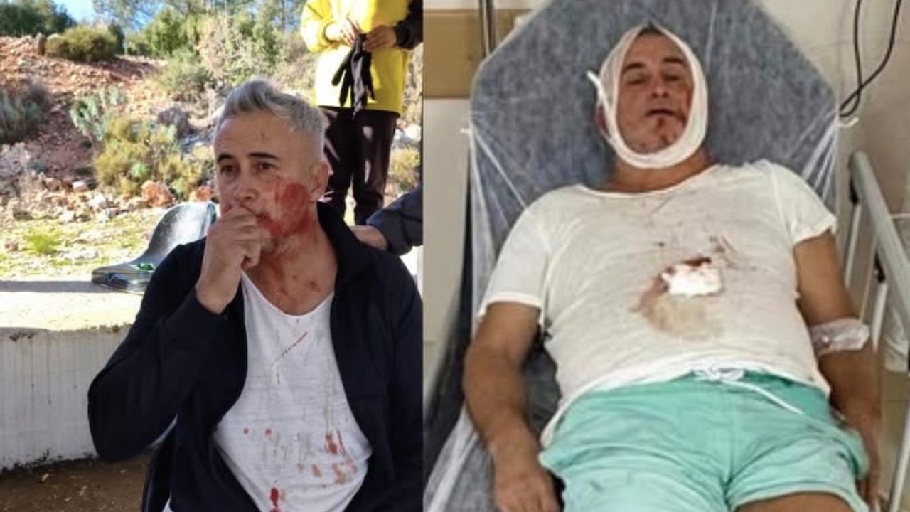 U14 maçı sonrası şiddet iddiası: Veli hastanede – Birlik Haber Ajansı